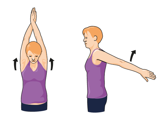 polyarthrite rhumatoïde